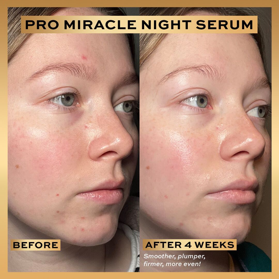 Miracle Night Serum Advanced Complex -- Gesichtsserum