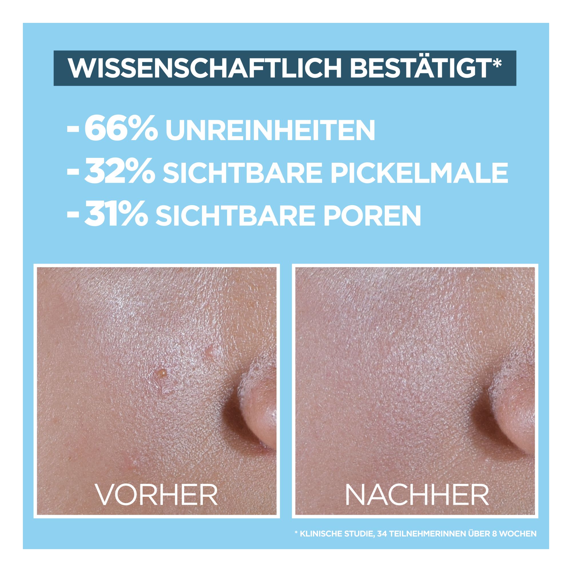 Fluide Anti Imperfections - Hautklar - BHA + Niacinamid Daily UV Anti-Unreinheiten Fluid