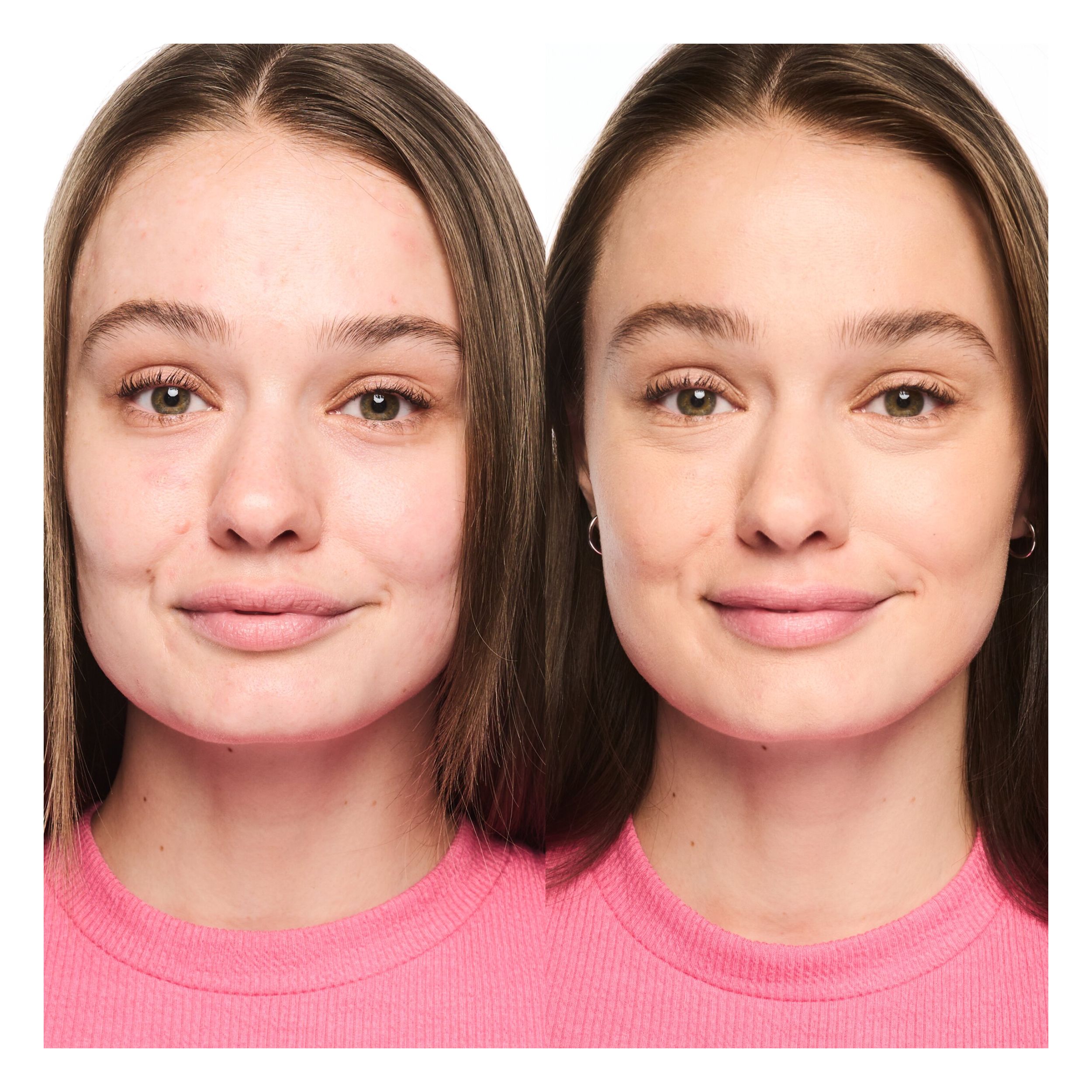 Foundation Stick