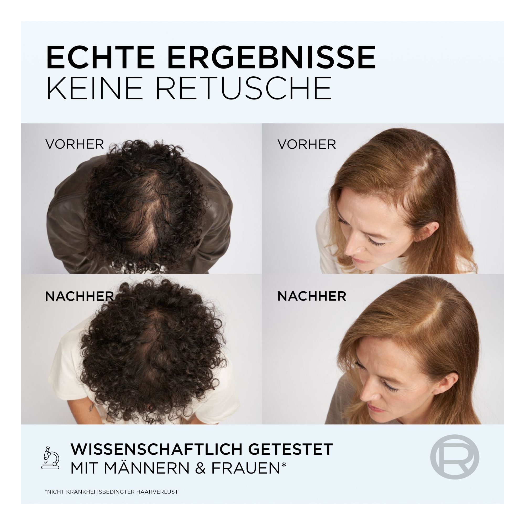 Anti-Hair Loss Serum - Elseve - Fiber Booster