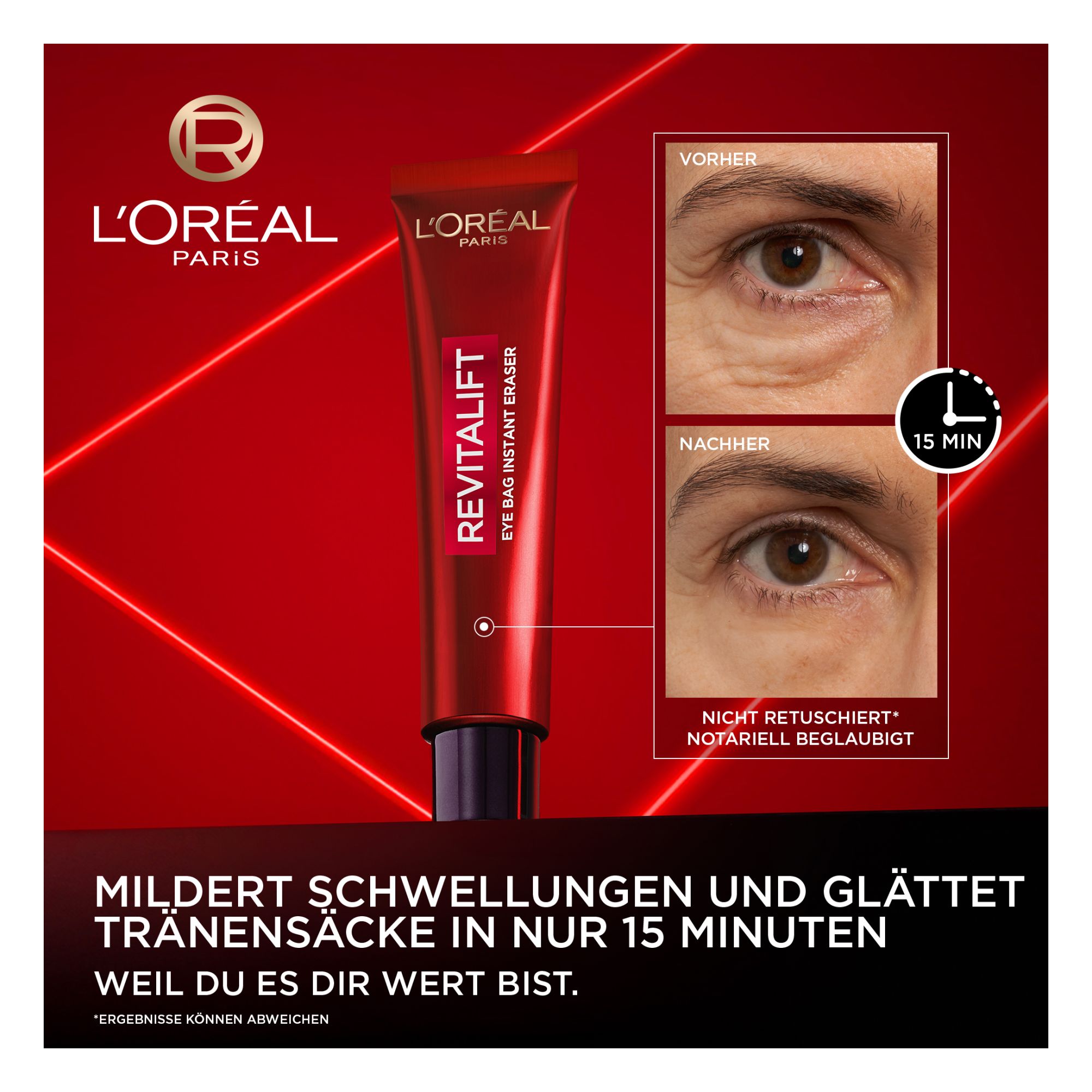 Revitalift Laser - Soin Anti-Poches Instantané Revitalift Laser - Soin Anti-Poches Instantané