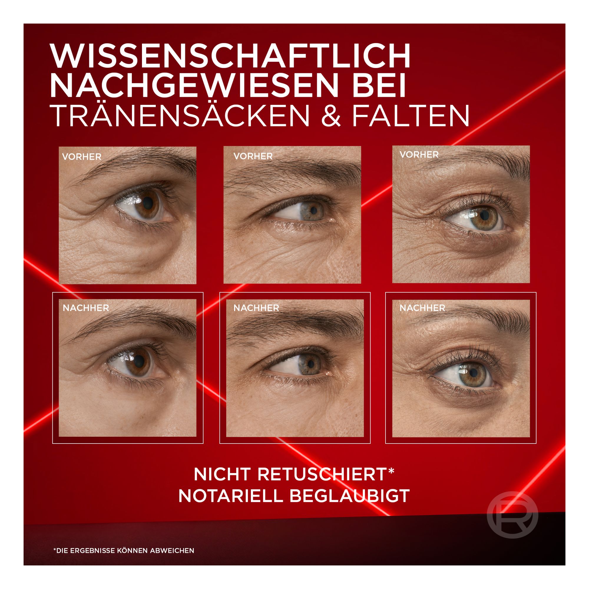 Revitalift Laser - Soin Anti-Poches Instantané Revitalift Laser - Soin Anti-Poches Instantané